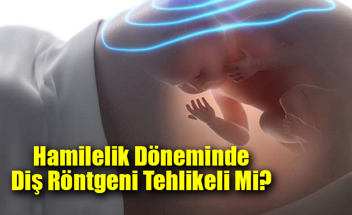 Hamilelik Döneminde Diş Röntgeni Tehlikeli Mi?