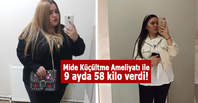 Mide Küçültme Ameliyatı ile 9 ayda 58 kilo verdi!