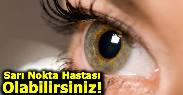 Sarı Nokta Hastası Olabilirsiniz!