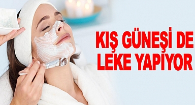 Kış Güneşi de Leke Yapıyor