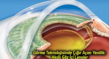 Görme Teknolojisinde Çığır Açan Yenilik: Akıllı Göz İçi Lensler
