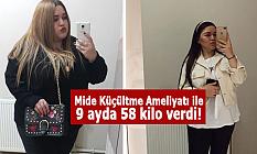 Lazer Epilasyon Izmir De Yives Clinic Farkiyla
