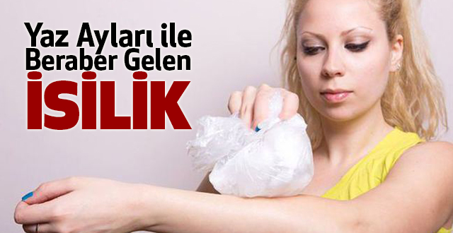 Yaz Ayları ile Beraber Gelen İsilik