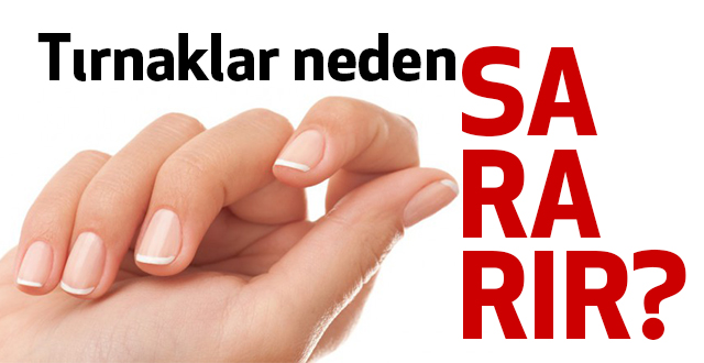 Tırnaklar neden sararır?