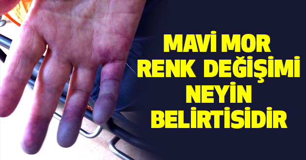 Mavi Mor Renk Değişimi Neyin Belirtisidir