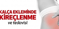 Kalça Ekleminde Kireçlenme
