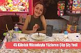 45 Kiloluk Vücuduyla Yüzlerce Çöp Şiş Yedi