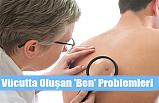 Vücutta Oluşan 'Ben' Problemleri