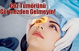 Göz Tümörünü Görmezden Gelmeyin!