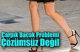 Çarpık Bacak Problemi Çözümsüz Değil