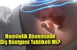 Hamilelik Döneminde Diş Röntgeni Tehlikeli Mi?