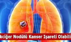 Akciğer Nodülü Kanser Işareti Olabilir
