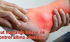 Gut hastalığı tedavi ile kontrol altına alınabilir