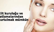 Cilt kuruluğu ve çatlamalarından kurtulmak mümkün