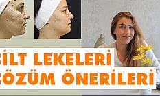 Cilt Sorunları ve Çözüm Önerileri