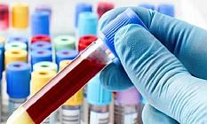 Cybh Testi Nedir?