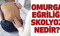 Omurga eğriliği SKOLYOZ nedir?