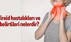 Tiroid hastalıkları ve belirtileri nelerdir?