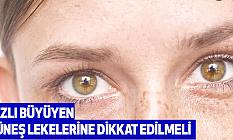 Hızlı Büyüyen Güneş Lekelerine Dikkat Edilmeli