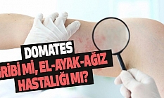 Domates gribi mi, el-ayak-ağız hastalığı mı?